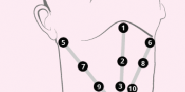 What is the difference between Dermal Fillers and Profhilo?