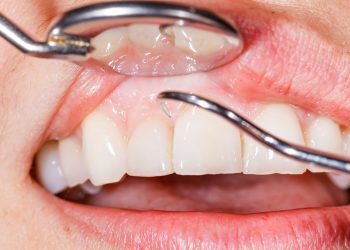Exploring the Importance of Visiting a Periodontist in London: 8 Compelling Reasons