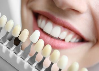 Enhance Your Oral Health and Appearance: The Significance of Top-notch Cosmetic Dentistry in Wycombe