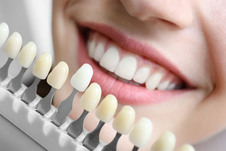 Enhance Your Oral Health and Appearance: The Significance of Top-notch Cosmetic Dentistry in Wycombe