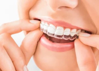 Say Goodbye to Braces Embarrassment: Introducing Invisalign Grays – The Ultimate Solution for Confident Orthodontic Care