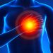 The Benefits of Seeking Care from a Private Specialist Doctor for Chest Pain
