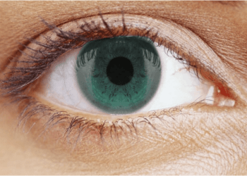 From Presbyopia to High Myopia: The Versatility of Lens Replacement Surgery