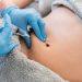 The Science Behind Fat Dissolving Injections: How They Work and What to Expect