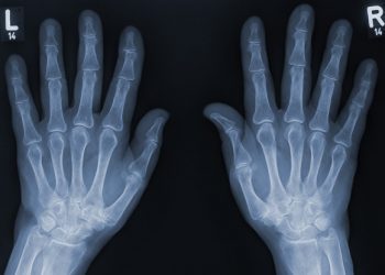 Navigating the Private X-ray Scan Journey: An Alternative to NHS