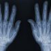 Navigating the Private X-ray Scan Journey: An Alternative to NHS